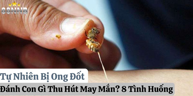 tự nhiên bị ong đốt đánh con gì 88nn thumb