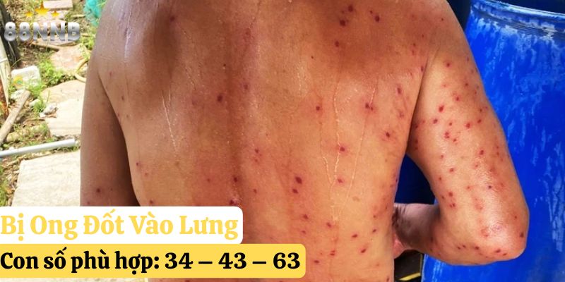 tự nhiên bị ong đốt đánh số gì