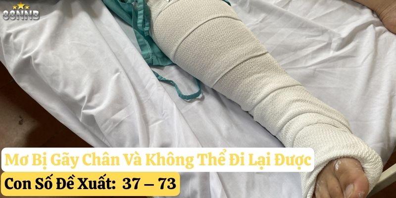 nằm mơ bị gãy chân