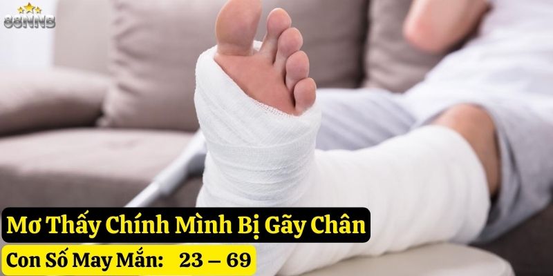 mơ bị gãy chân 88nn