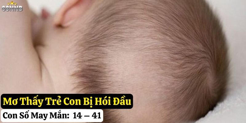 mơ thấy hói đầu