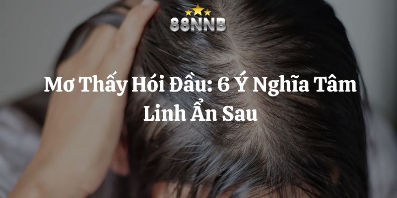 mơ thấy hói đầu 88nn thumb